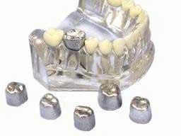 Tin Crown (Directa)